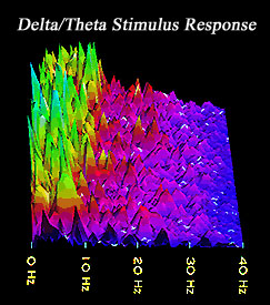 Delta/Theta Stimulus Response